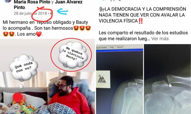 Merlo: ¿Álvarez Pinto usó una fractura del 2018 para acusar a ATE?